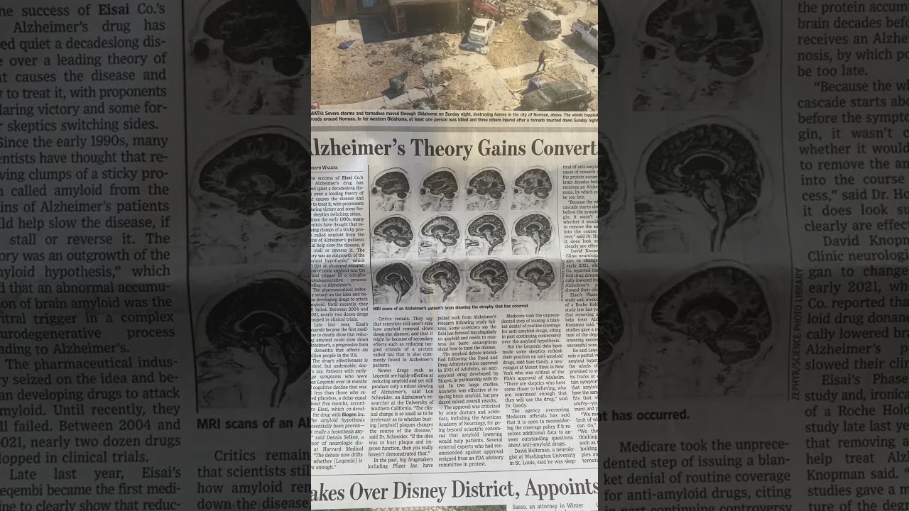 #alzheimer