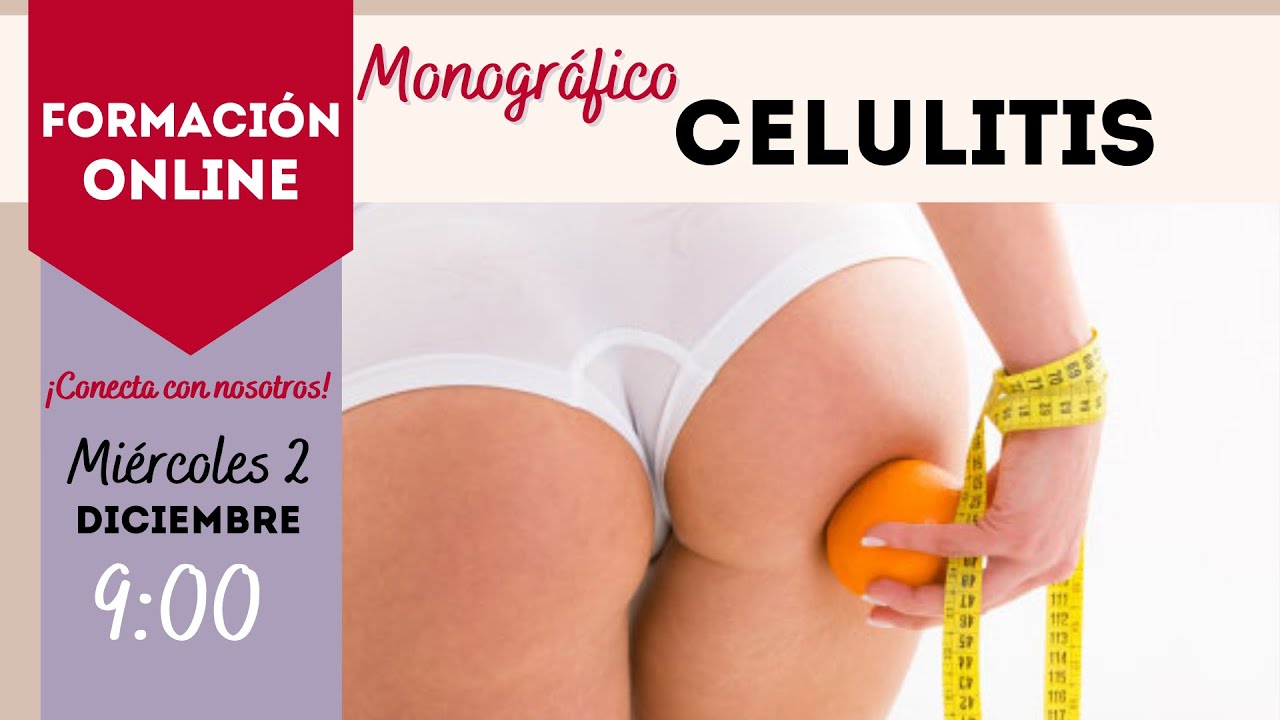 Celulitis 1: El diagnóstico acertado es el éxito del tratamiento.