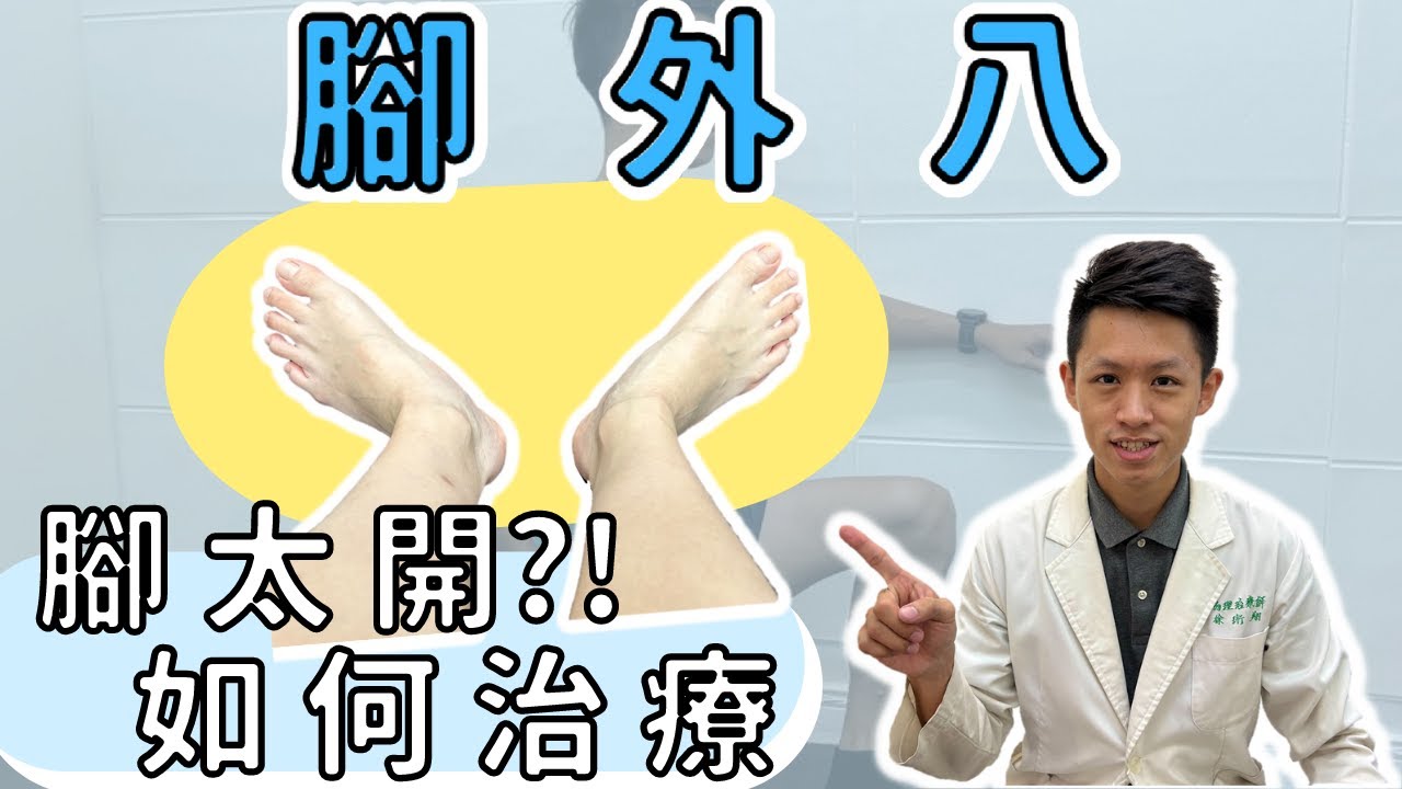 盤腿翹腳會不會造成腳外八？腳外八會不會影響髖關節？腳外八、胯下腳太開，該如何改善？