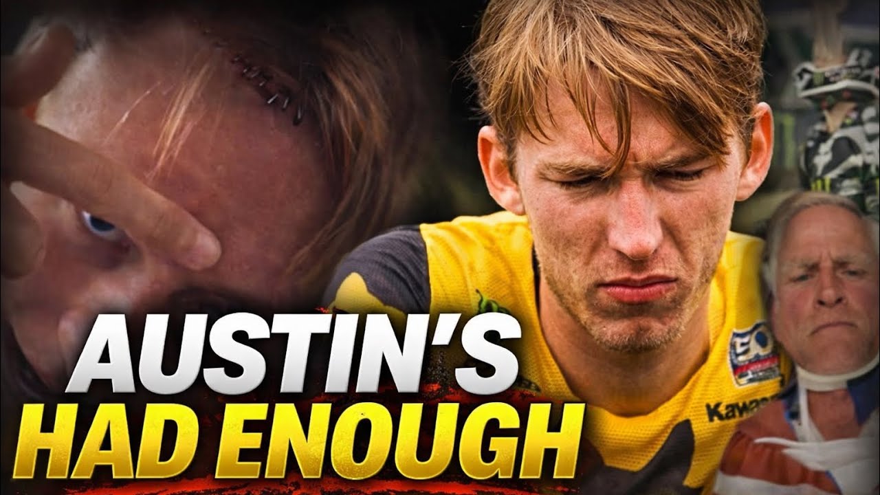 Austin - Sorry Ricky - ITS OVER 