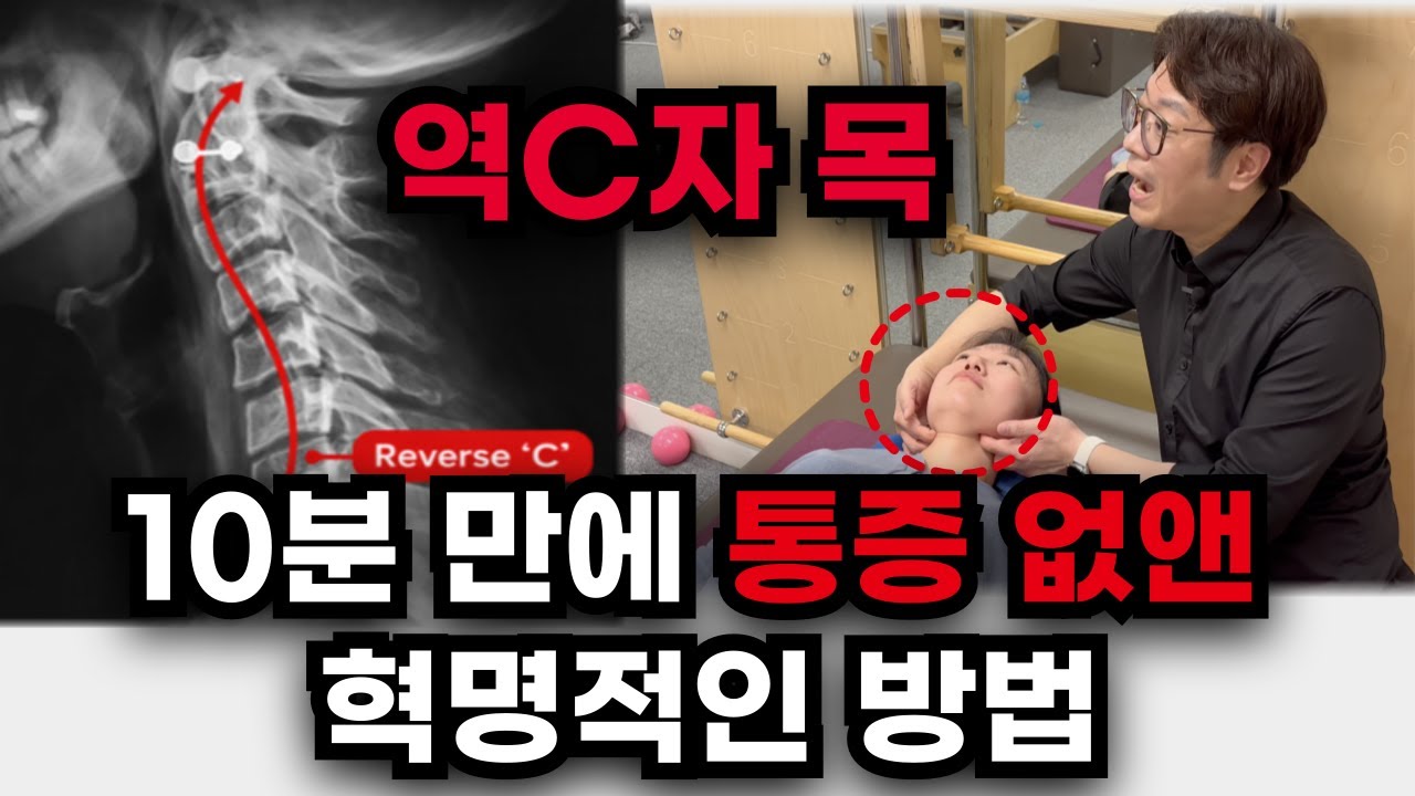 목 어깨 아픈 사람은 이것 부터 아셔야 합니다 | 통증을 없애는 기적의 솔루션