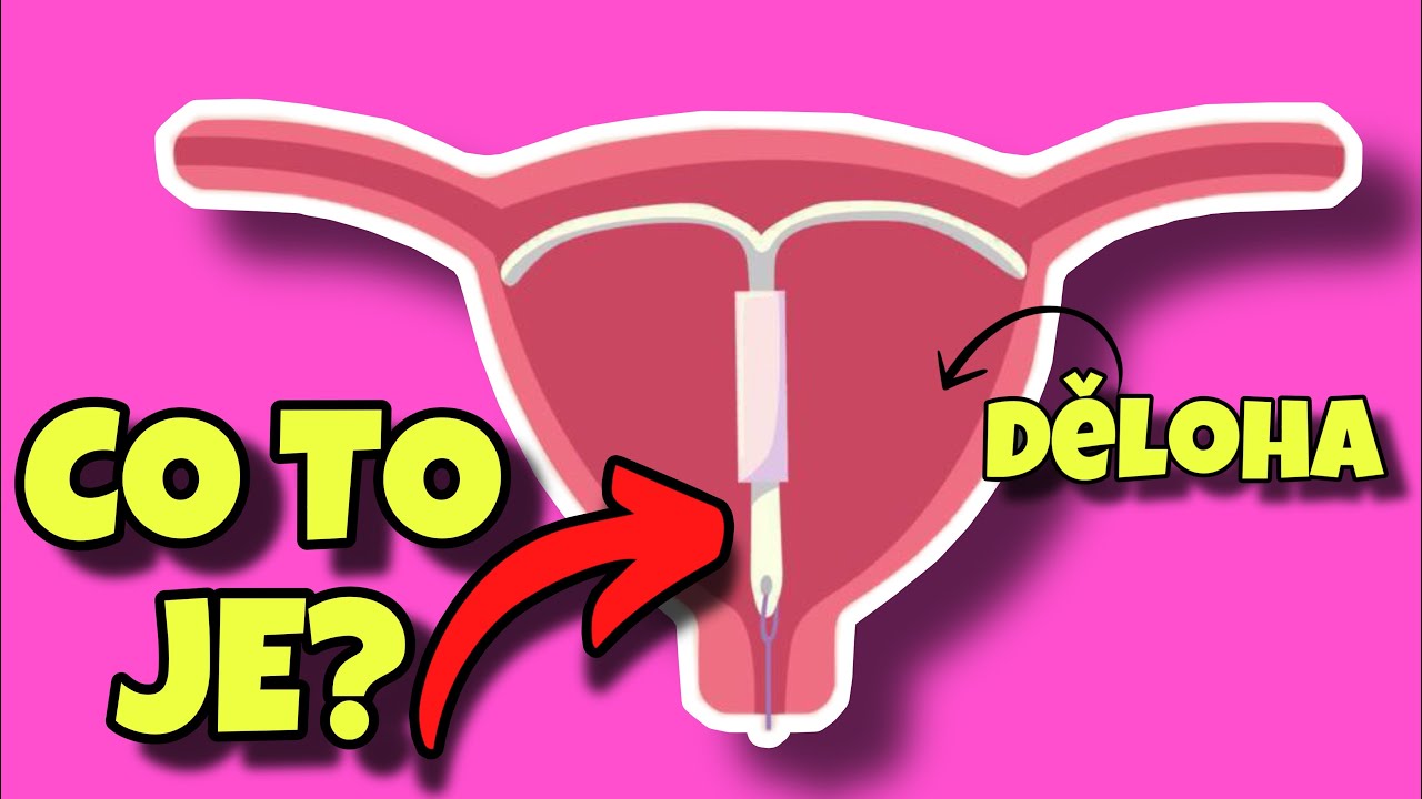 CO JE TO NITRODĚLOŽNÍ TĚLÍSKO A JAK FUNGUJE? (hormonální, nehormonální typ)