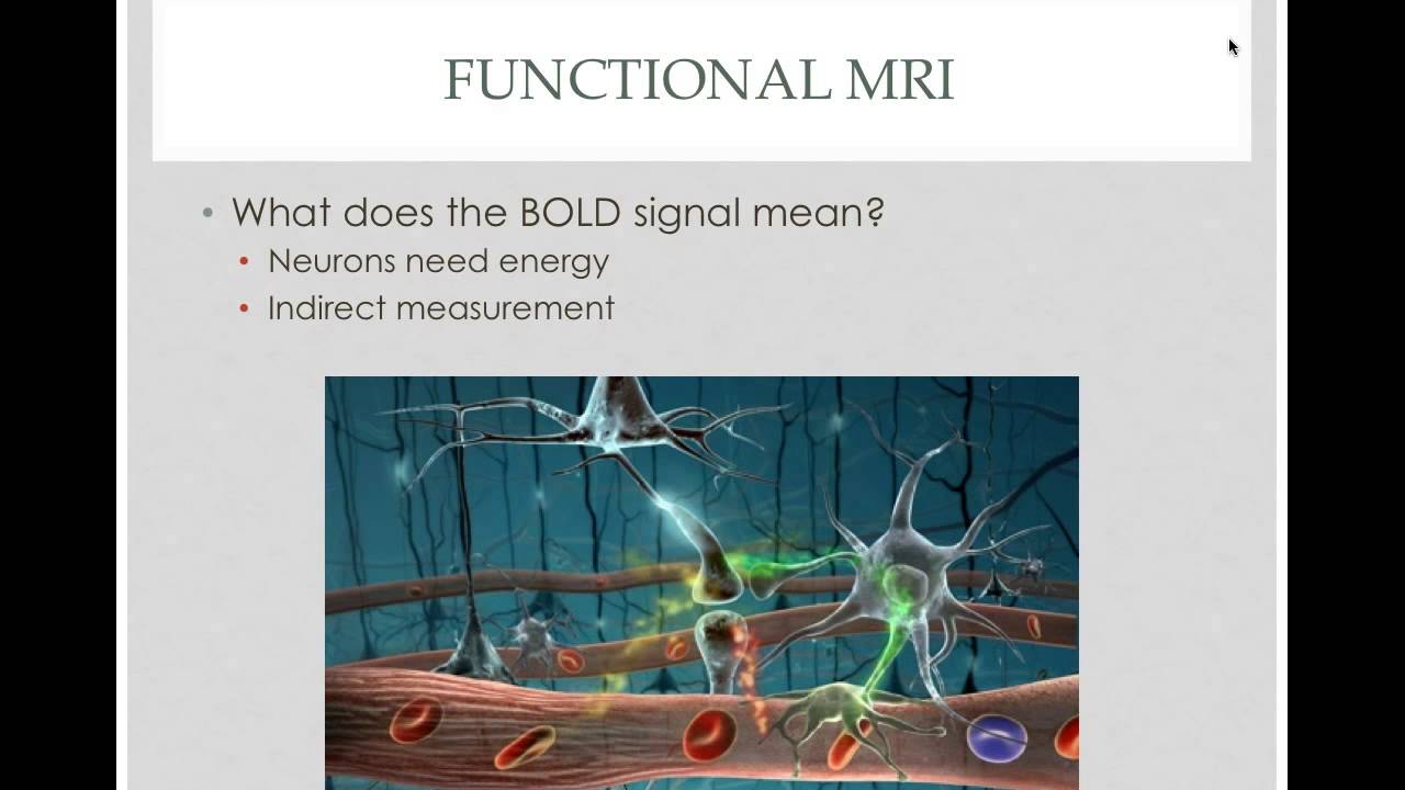 The language of fMRI research
