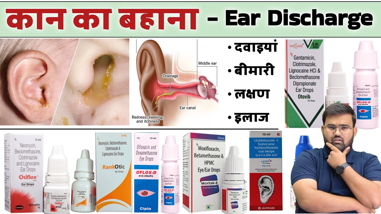कान का बहना | Ear Discharge | Ear Infection | Ear Drop | Medicine | Treatment | Pharmacy | Doctor 