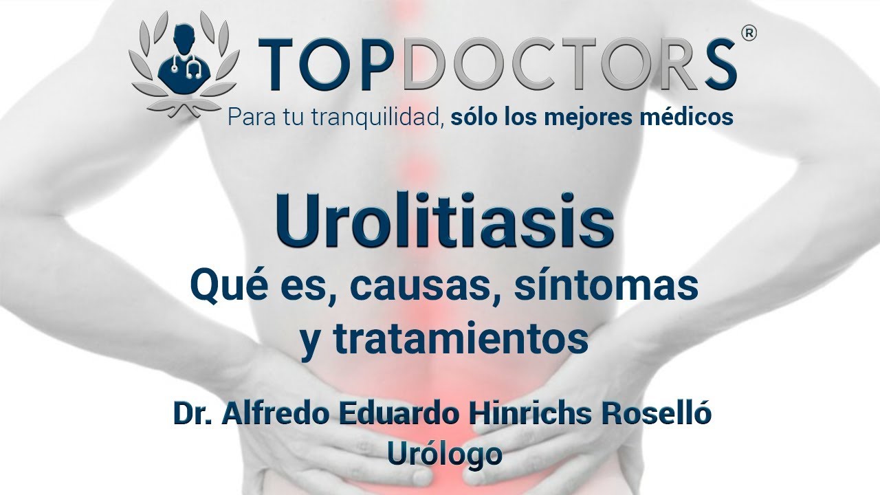 &iquest;Qu&eacute; es la urolitiasis? Conoce todos los detalles