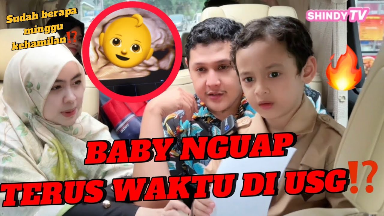 BABY NGUAP TERUS WAKTU DI USG⁉️ YUSUF PINGIN ADEK CEWEK ATAU COWOK⁉️