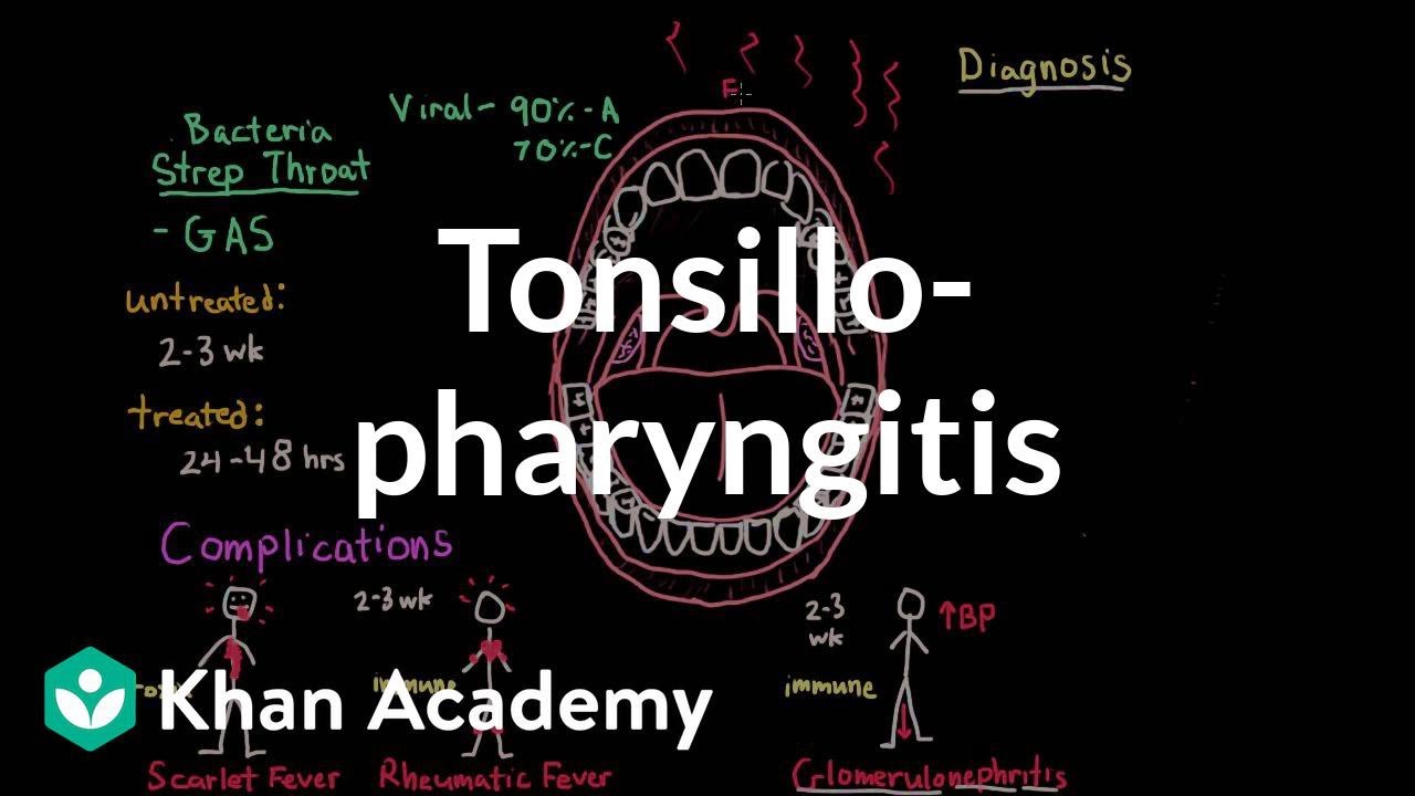 Tonsillopharyngitis - Complications, diagnosis, and treatment | NCLEX-RN | Khan Academy