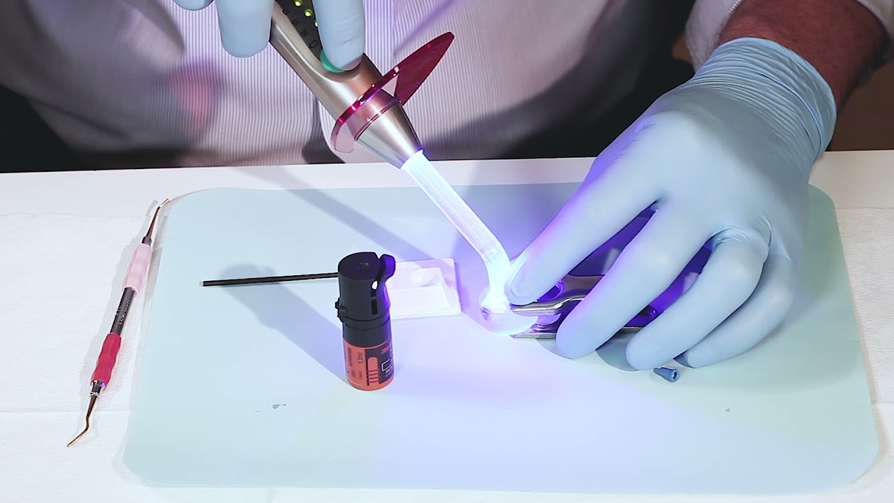 Video caso clínico Adhesivo 3M™ Scotchbond™ Universal