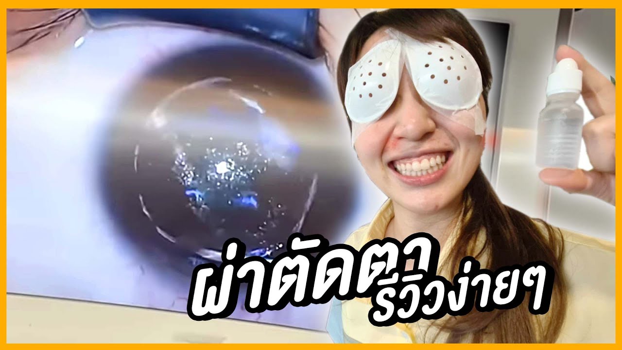 👁️👁️ รีวิวผ่าตาแบบมีคลิป คนผ่าสบาย คนถ่ายจะเป็นลม