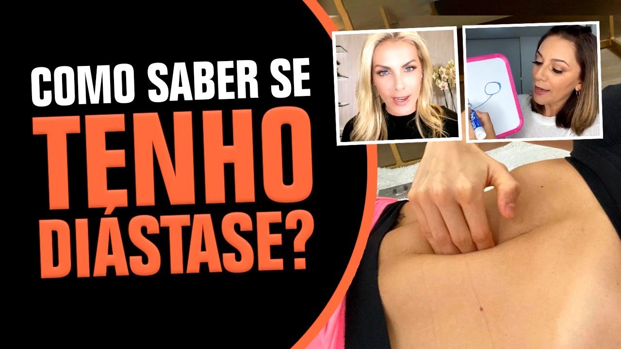 Como saber se eu tenho Diástase? Gizele Monteiro explica!