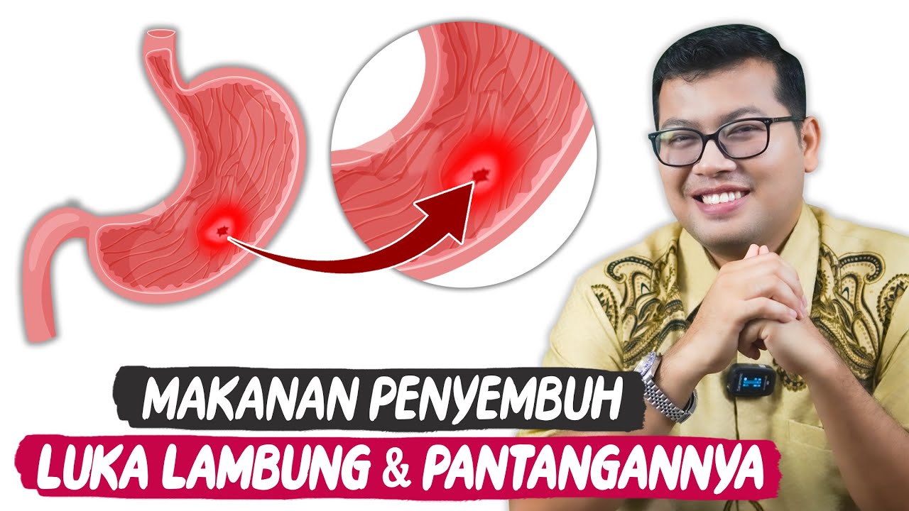 MAKANAN UNTUK LUKA LAMBUNG BESERTA PANTANGANNYA - DOKTER SADDAM ISMAIL