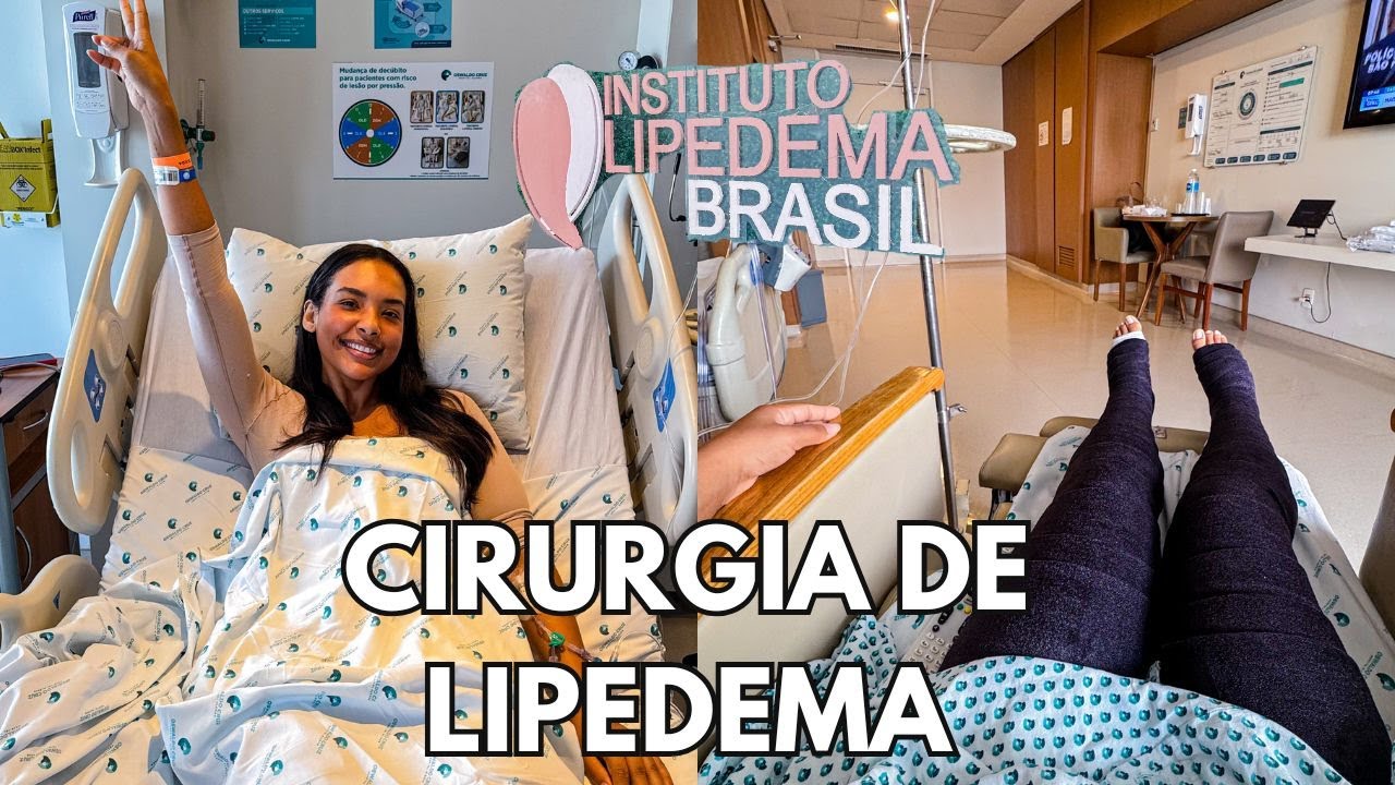 FIZ A CIRURGIA DE LIPEDEMA | me preparando para a cirurgia e primeiros 5 dias de pos operatório