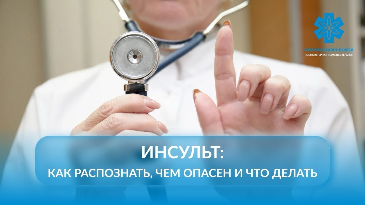 Инсульт: как распознать и что делать? Симптомы, первая помощь, методы лечения