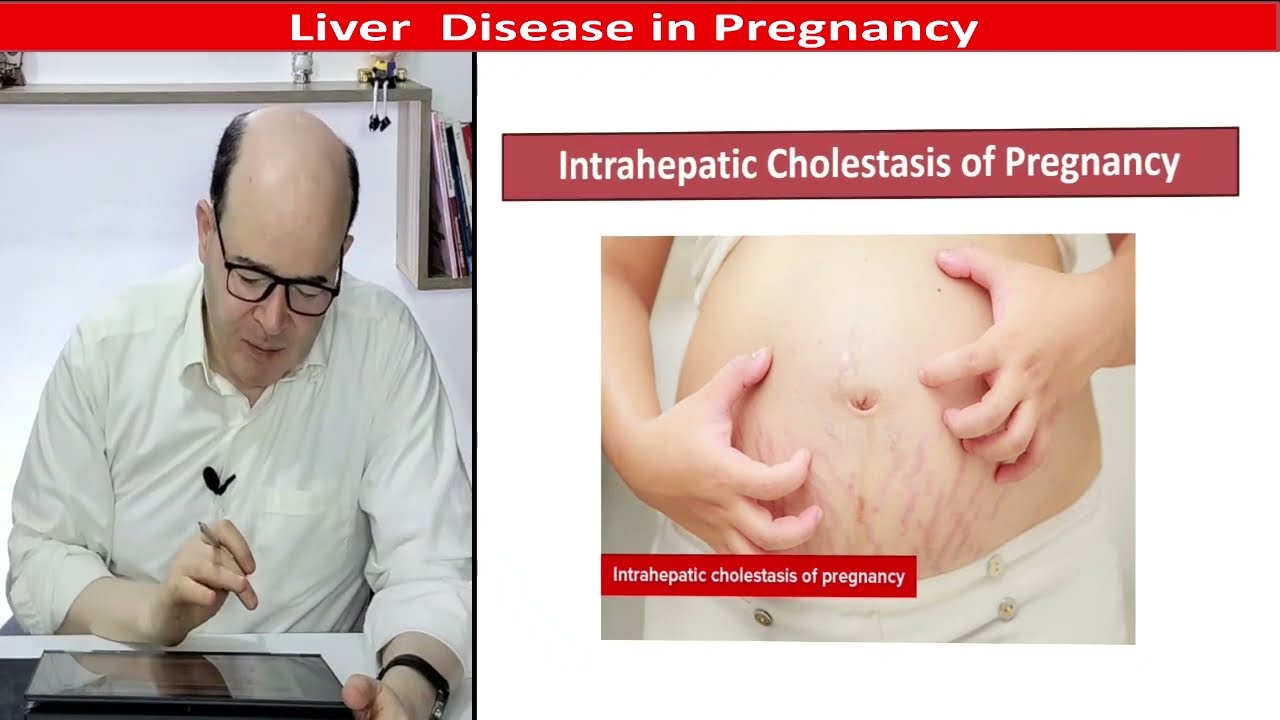 Live Disease in Pregnancy
