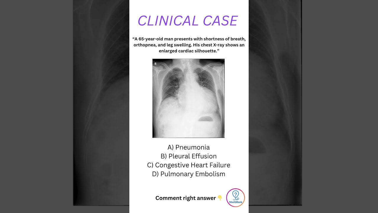 💔 Clinical Case Quiz: Can You Diagnose Heart Failure? | MedQuiz