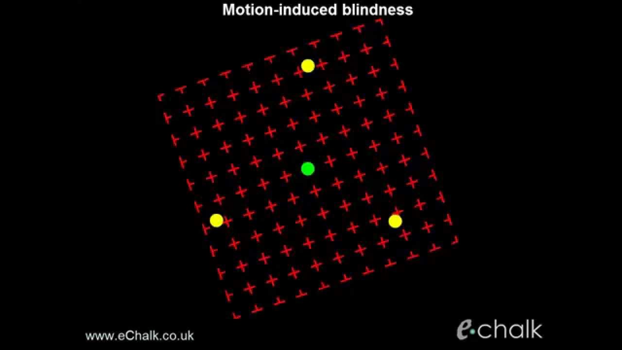 Motion-induced blindness: test for the severity of ADHD : eChalk illusion
