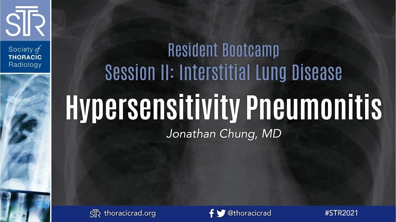 Hypersensitivity Pneumonitis