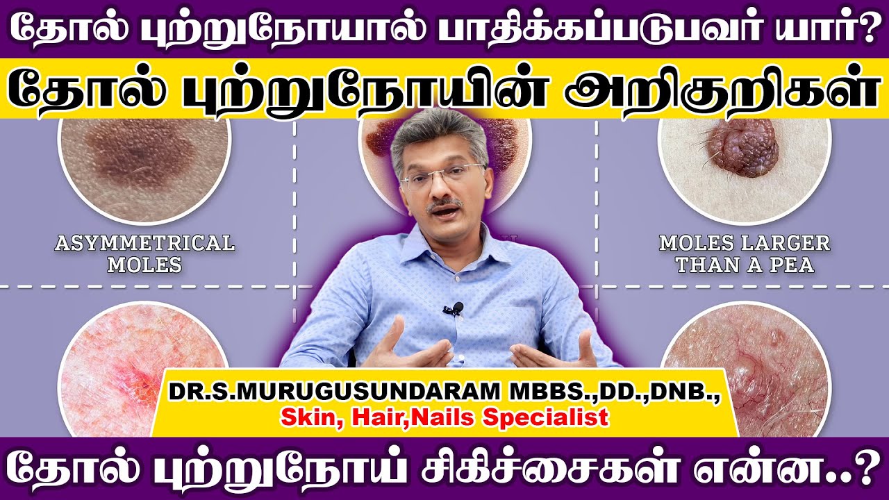 தோல் புற்றுநோயால் பாதிக்கப்படுபவர் யார்? தோல் புற்றுநோயின் அறிகுறிகள் | Dr.S.Murugusundaram