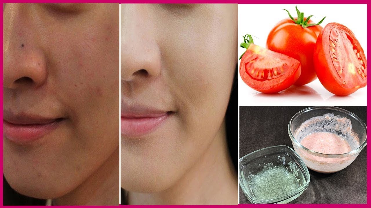 How To Remove Sun Tan in 1 Day - Magical Sun Tan Removal Remedy at Home