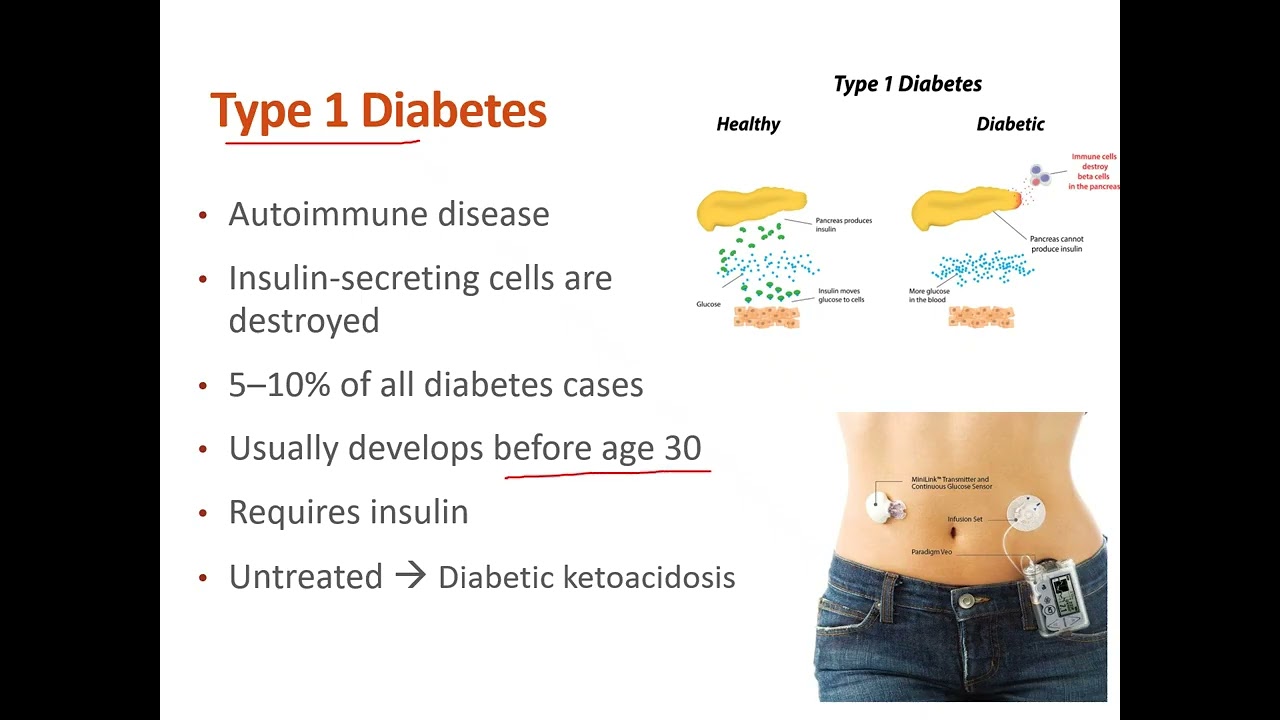 Ch4_Diabetes