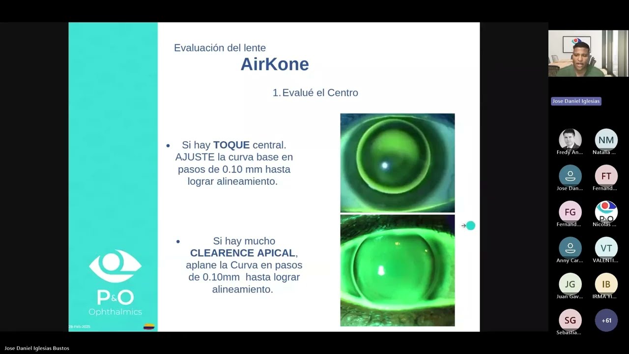 🎥 Webinar Lentes Corneales para Queratocono | Dr. José Iglesias | P&O Ophthalmics (Parte 1)