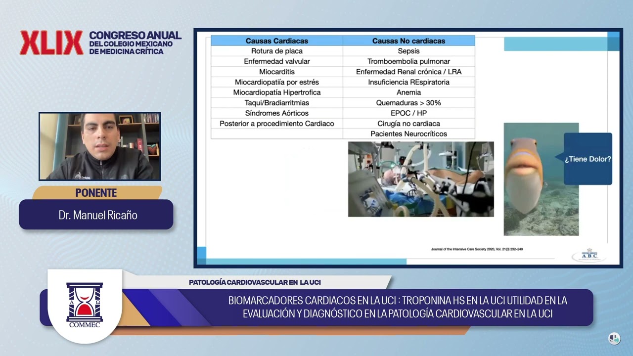 4 Manuel Rica&ntilde;o Biomarcadores cardiacos en la UCI