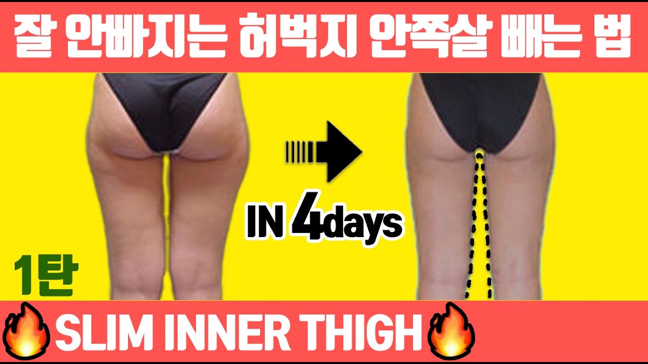 🔥허벅지 안쪽살🔥빨리 빼려면 1달만 이 루틴 하세요(안벅지 제거/허벅지살)