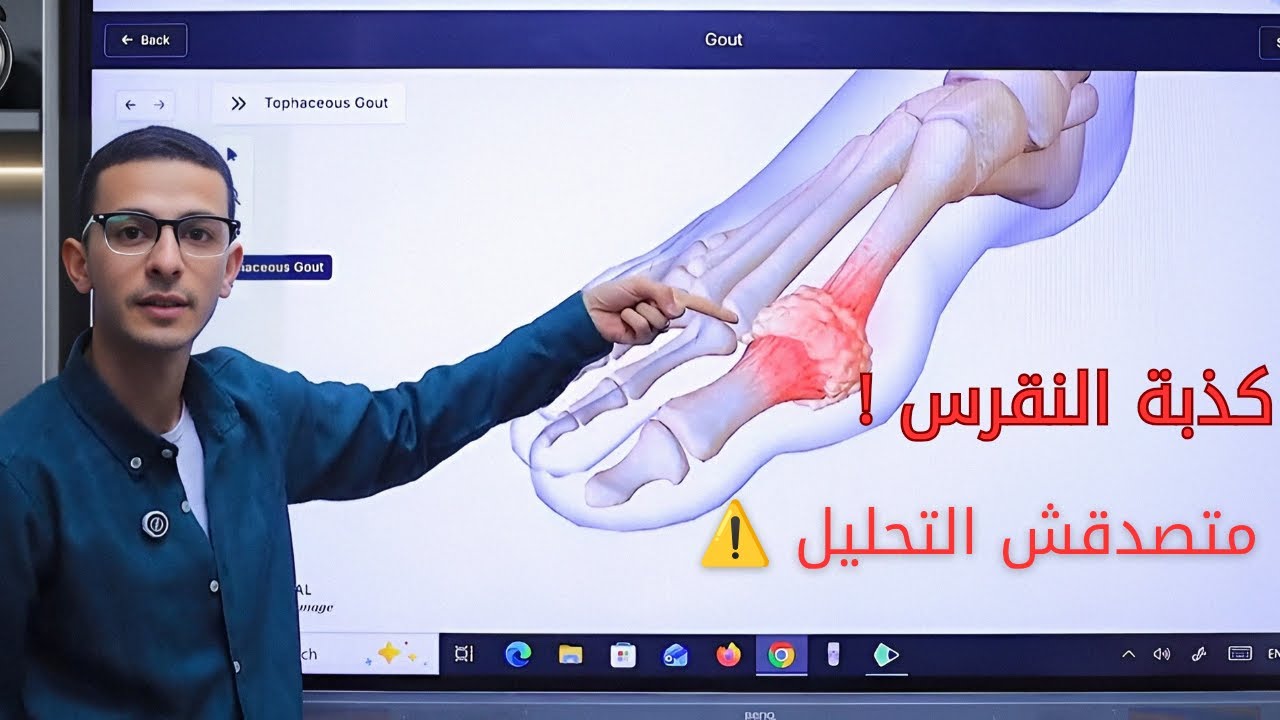 اكبر خرافة طبية ......نص الناس مصدقينها