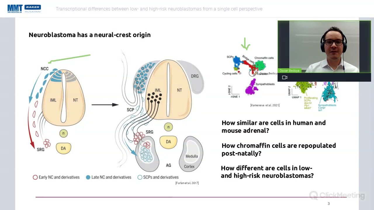 Transcriptional differences between low and high risk neuroblastomas from a single cell perspective