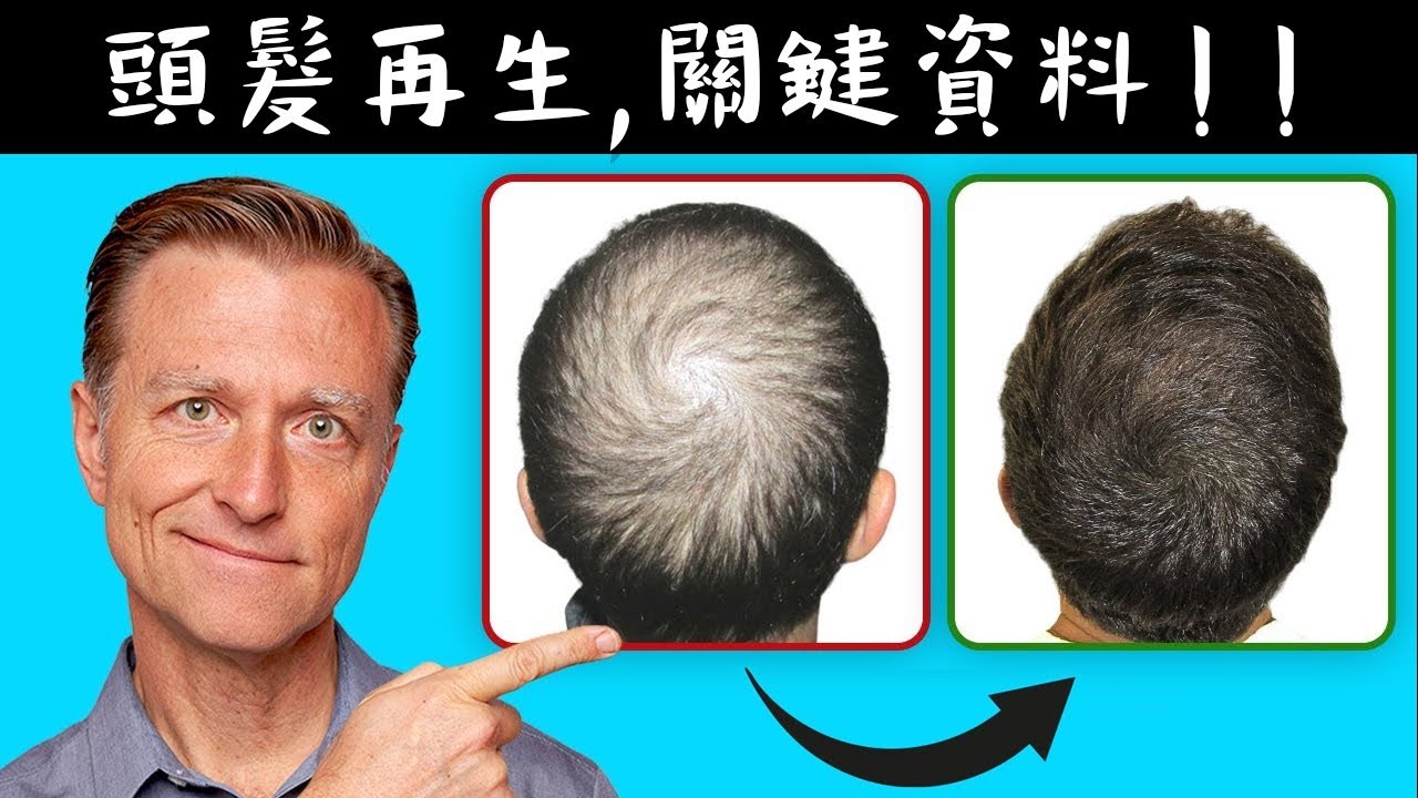 停止掉髮！紅肉和雞蛋的驚人效果