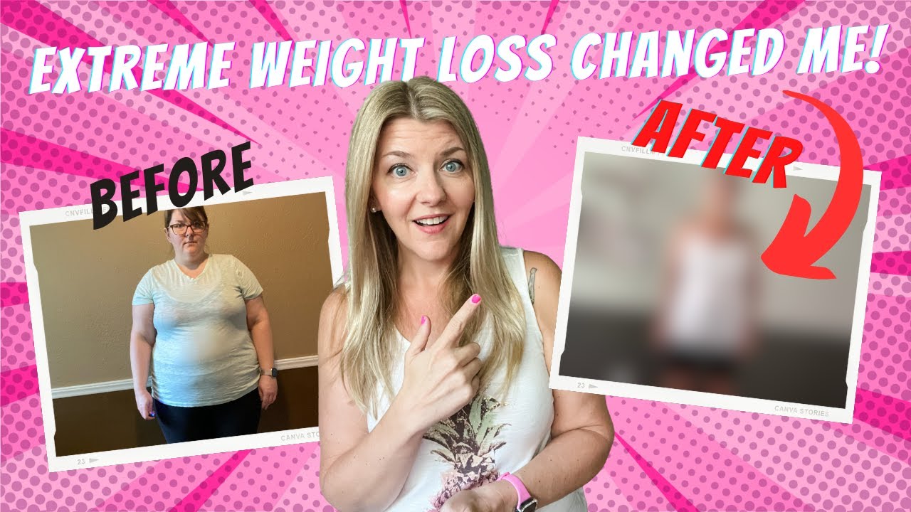 Weight Loss Surgery CHANGED My LIFE | My VSG Weight Loss Journey 1 Year Post-Op