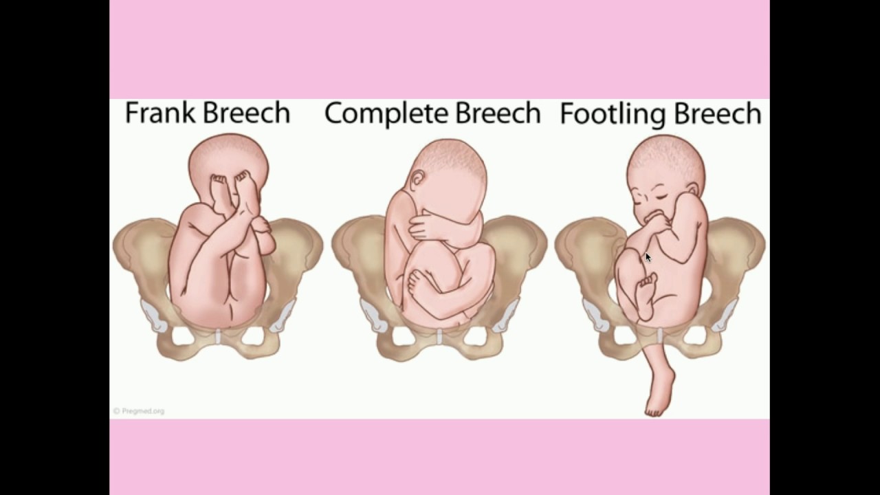Normal Labor and Delivery - CRASH! Medical Review Series