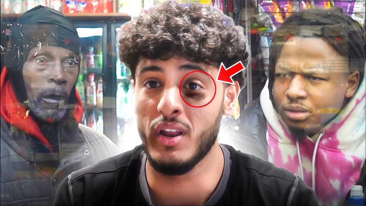 Customers in the Hood React to my Black eye (Part 3) | Nick came back
