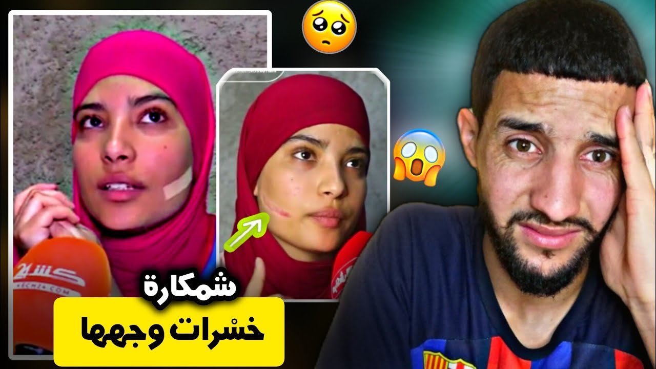 #كلنا_سلمى السجن لشمكارة لي خسْرات ليها وجهها 🤯🥺