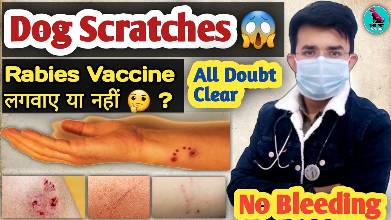 Dog Scratch 😱 Should you get Rabies Vaccine or not 🤔? There was no bleeding || All Doubts Clear |...