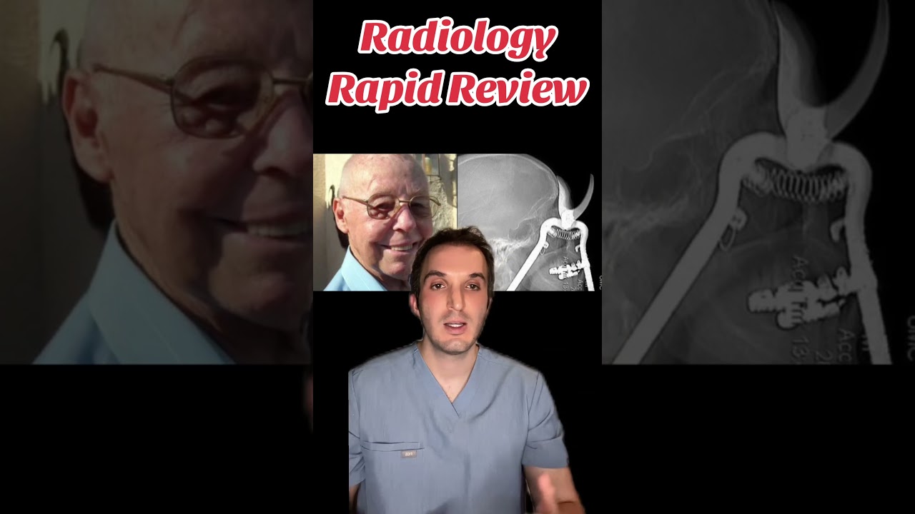9 crazy radiology cases in 1 minute