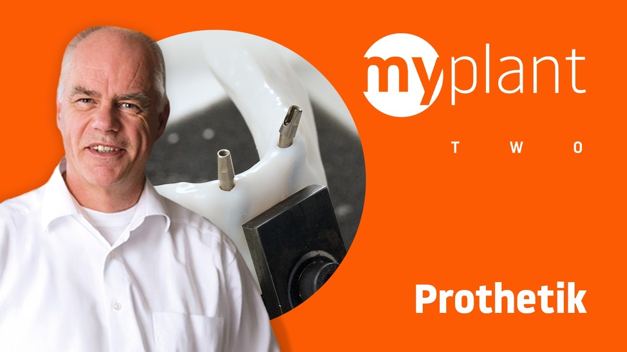Prothetische Versorgung des myplant two