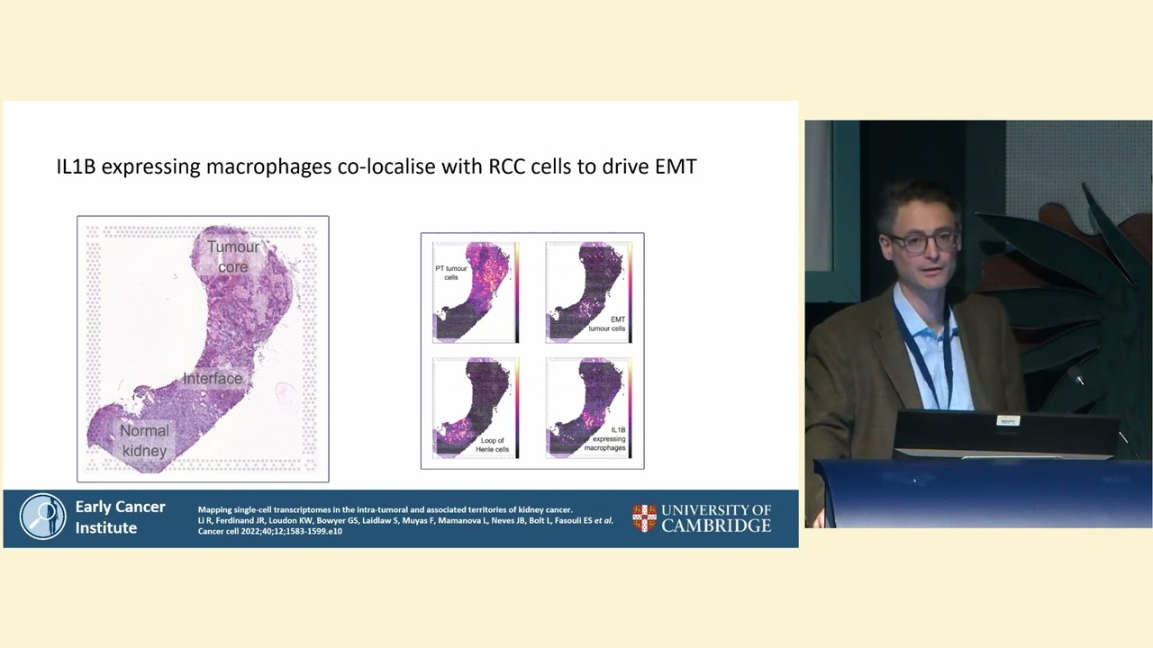 Exploring the Molecular Basis of VHL &ndash; Tumor Heterogeneity in VHL ccRCC | Medical Symposium 2024