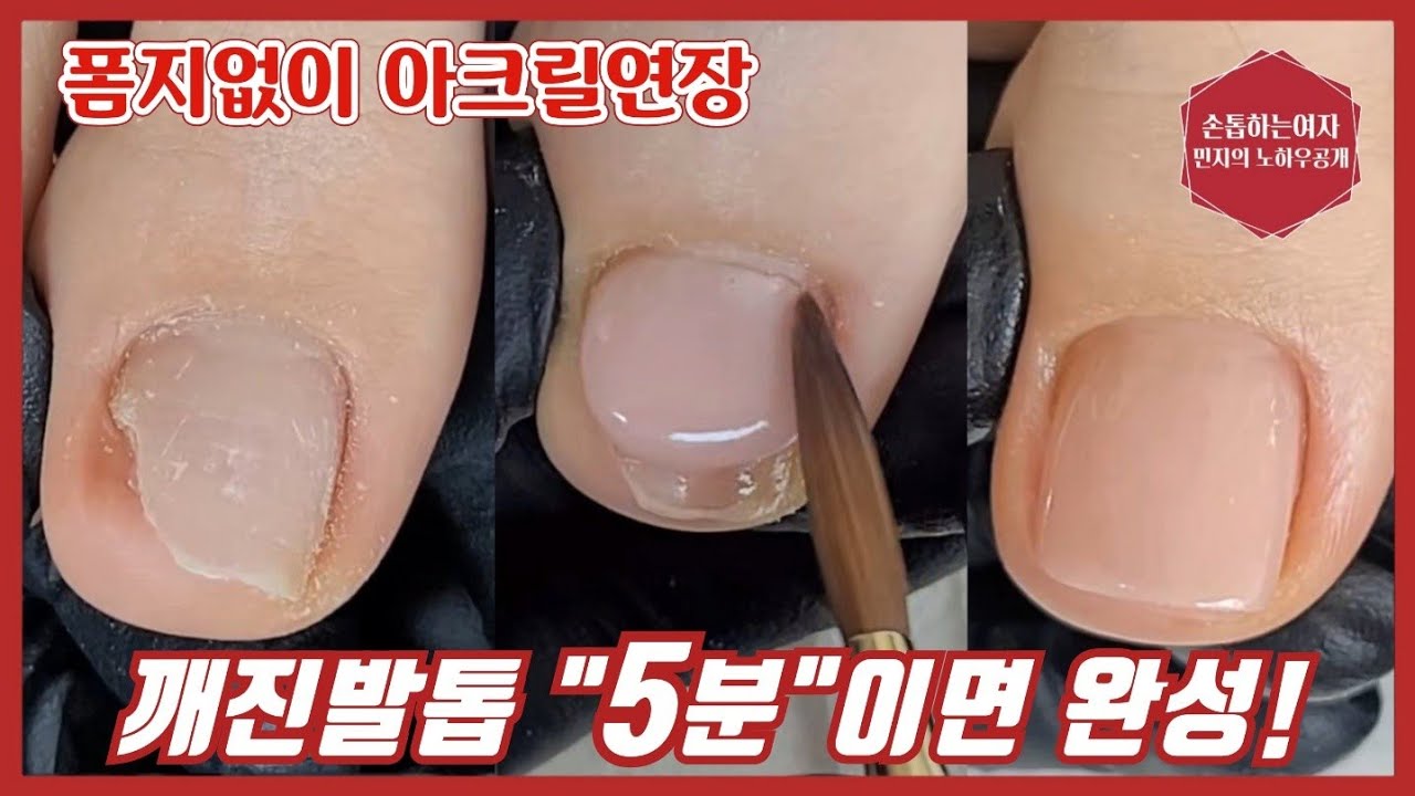제88화[깨진발톱연장]아크릴을이용한 5분완성발톱연장!! 폼지없이 감쪽같은연장법/민지의노하우 공개!!!