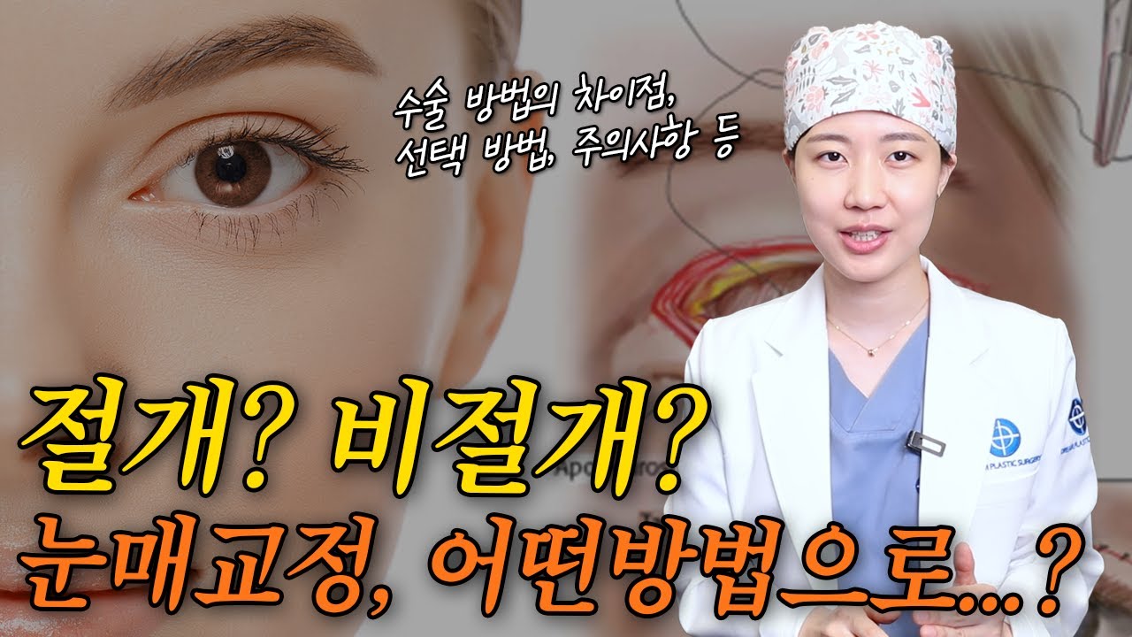 졸린 눈? 안검하수? 절개, 비절개 눈매교정 알아보기