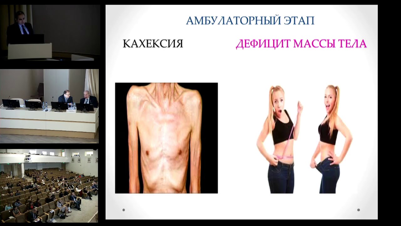 Клиническое питание в онкологии  Меликов С.А.