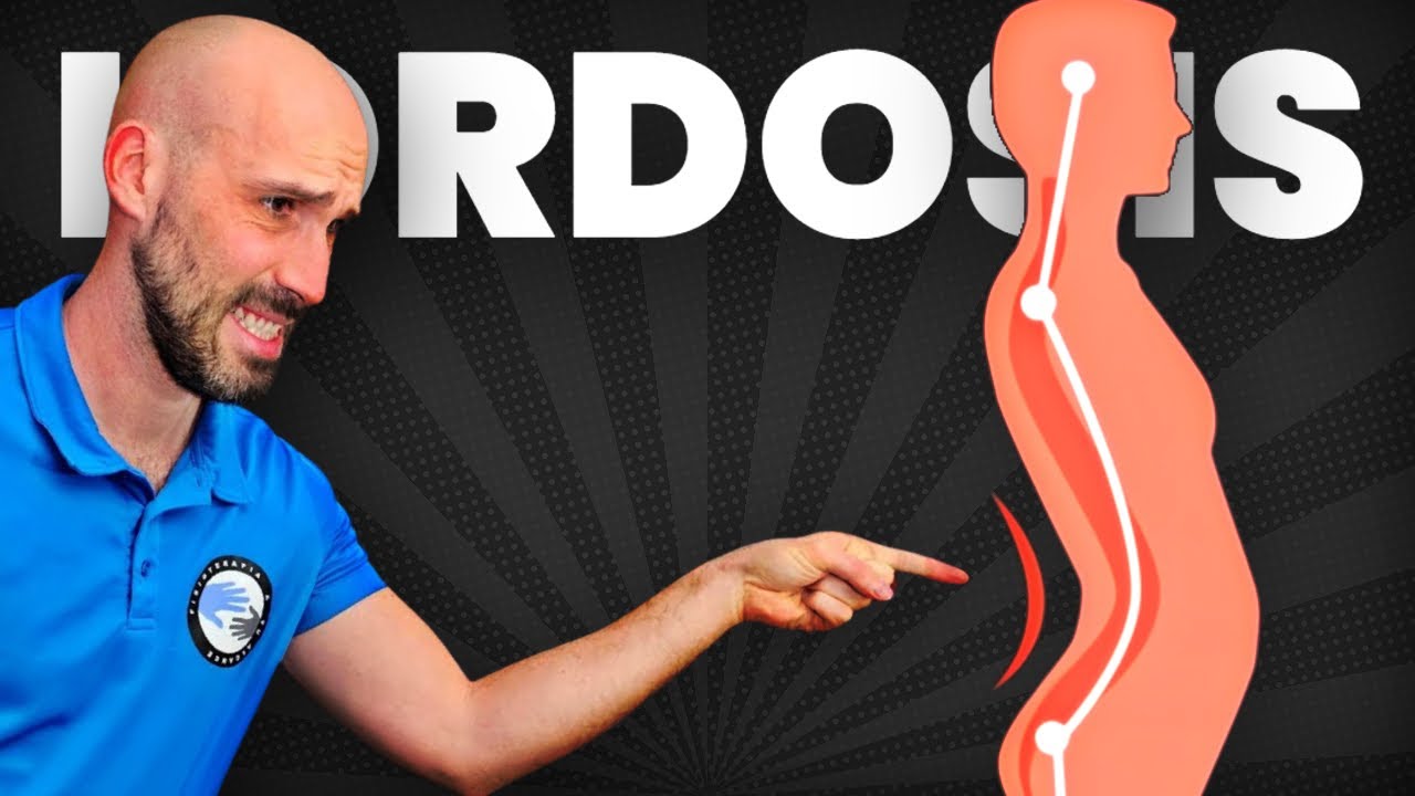 HIPERLORDOSIS LUMBAR: 6 ejercicios CLAVE para CORREGIR tu espalda arqueada
