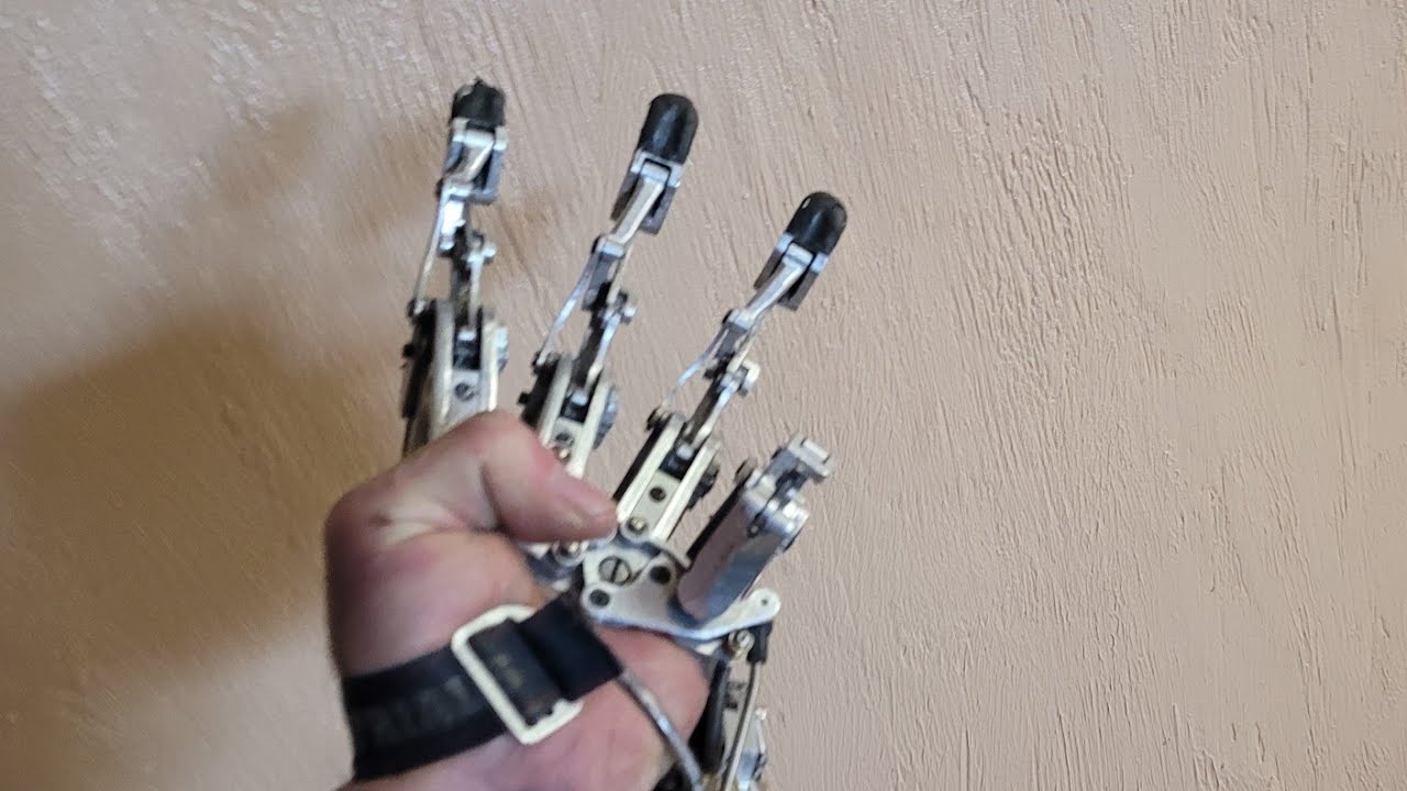 3D Printed Prosthetic Hand  DIY Video No.3  Making a Check socket.