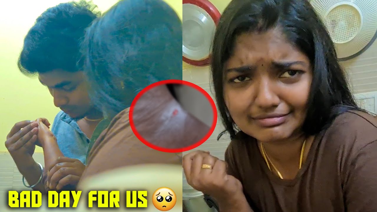 💔சிவா சூடு வச்சுட்டான்😢இன்னைக்கு  எனக்கு TIME சரியில்ல 😭😭#prashanyasiva #editorsiva #couplevlog