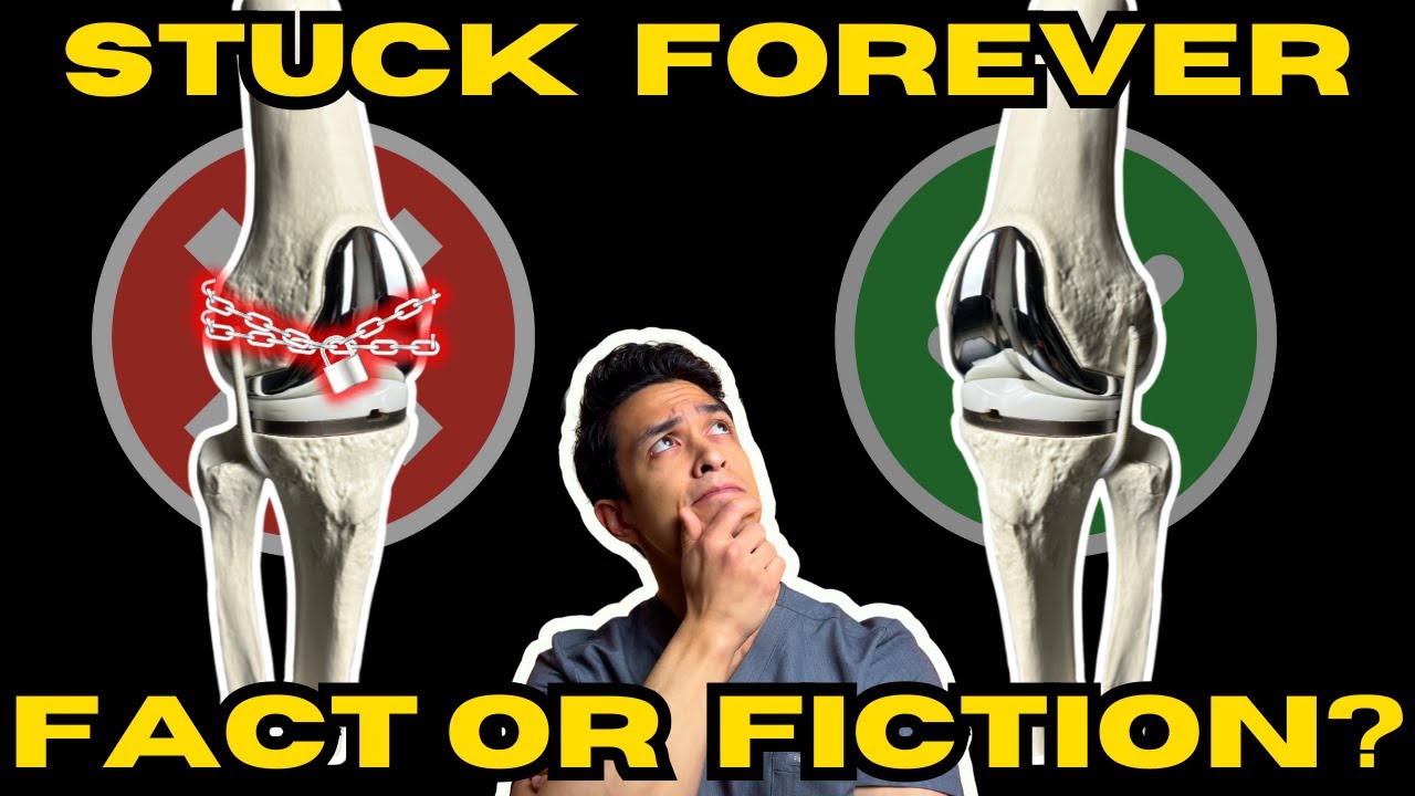 Knee Replacement Stiffness: Fact or Fiction?