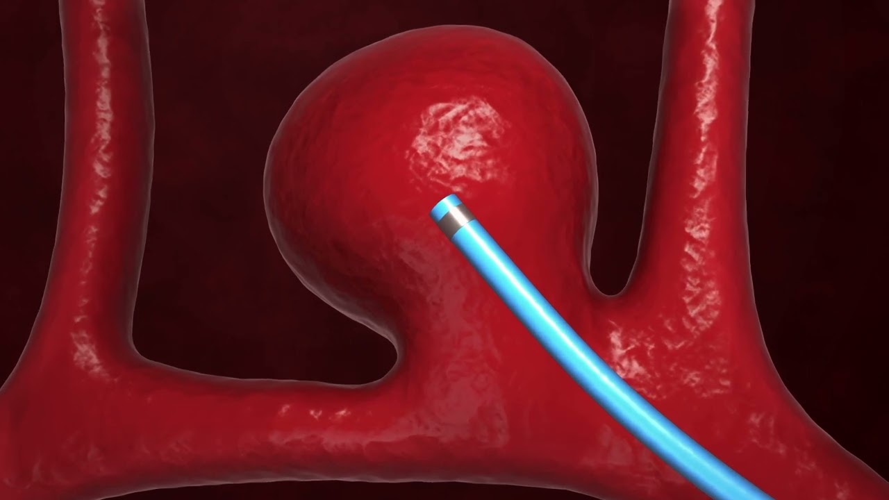 Luseed vascular