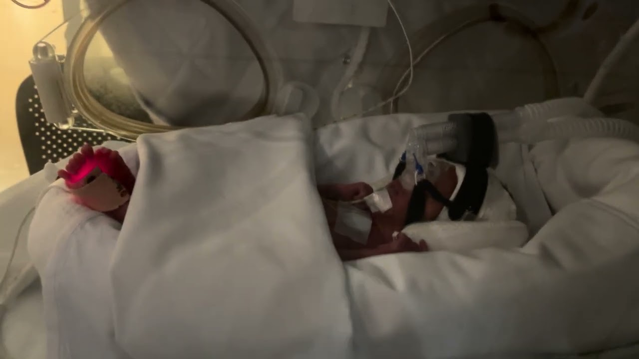 Day 6 of life August 7, 2024