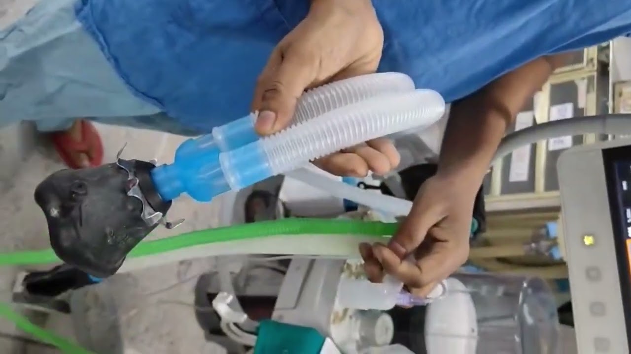 OT Theatre এ কিভাবে Anesthesia দেওয়া হয় !  Part - 1