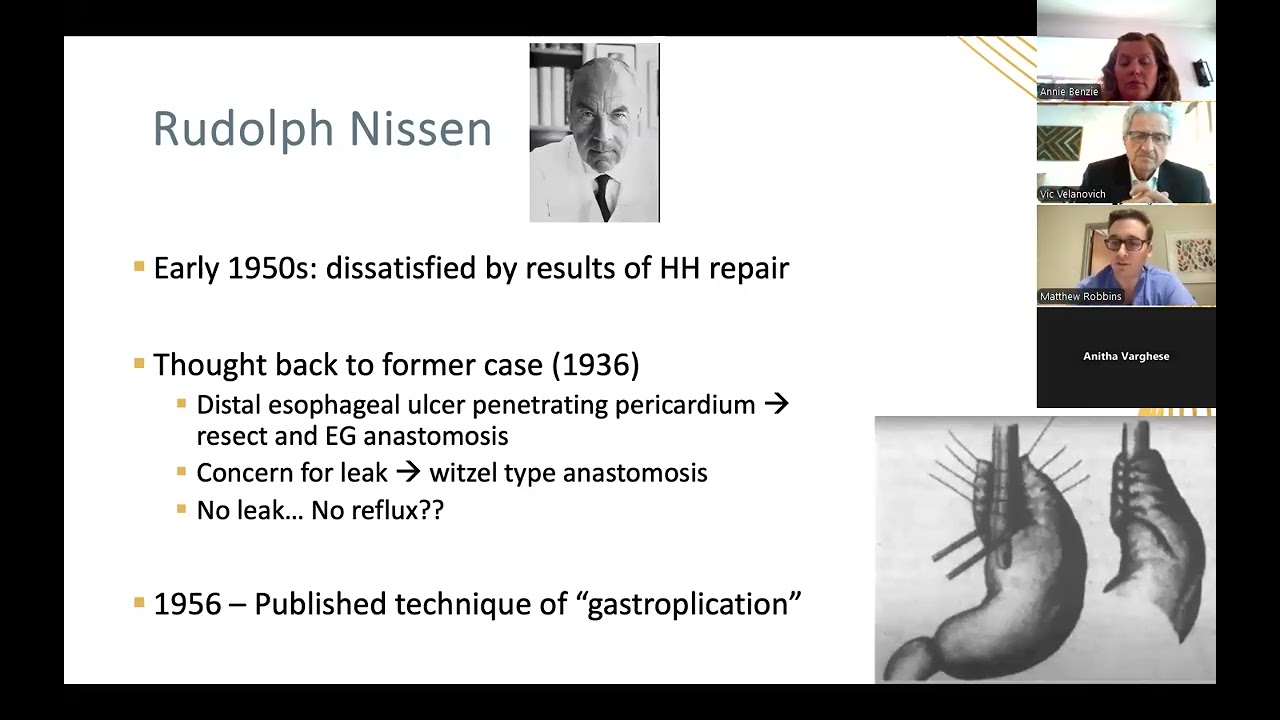SSAT Complex GS Fellowship Virtual Grand Rounds Webinar: Paraoesophageal Hernias
