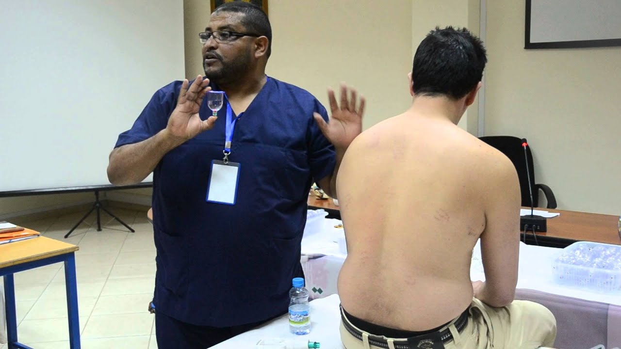 مقتطف  من  تطبيقات  في الحجامة ذ محمد بلهنتوت